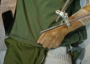 Військовим в опорних лікарнях видаватимуть «пакунок пораненого»