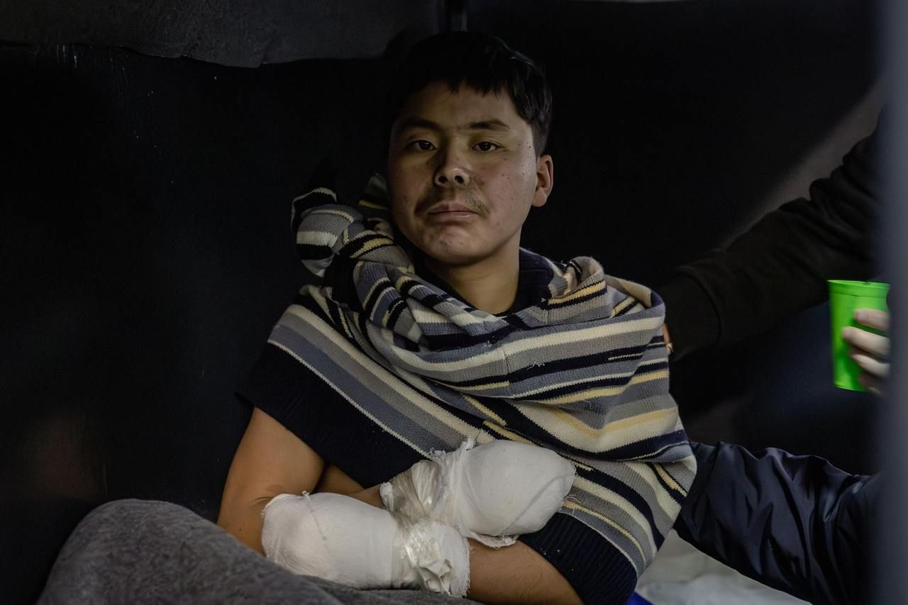 Пленен войник на КНДР. Снимка от СБУ