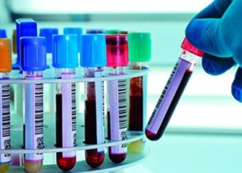 У Хмельницькому запрацює ДНК-лабораторія для ідентифікації загиблих військових