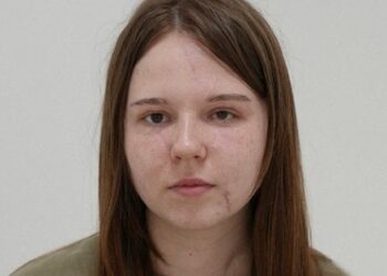 Львівські пластичні хірурги відновлюють обличчя 20-річній дівчині з Луганщини