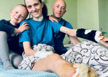 Львов қаласынан ауыр жарақат алған Лайман тұрғыны Швецияға емделуге жеткізілді