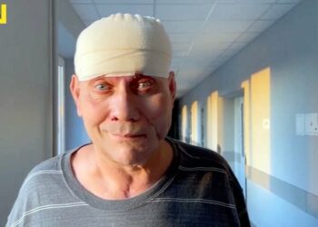 Украиналық және канадалық дәрігерлер Херсон облысының тұрғынына тіндерді артқа ауыстырды