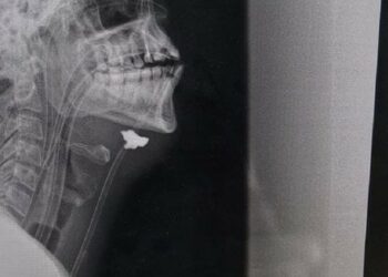 Львівські лікарі у прифронтовій лікарні врятували бійця з розривом сонної артерії