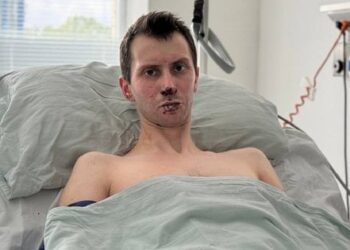 Львівські комбустіологи врятували 30-річного захисника з Волині, який обпік 50% тіла