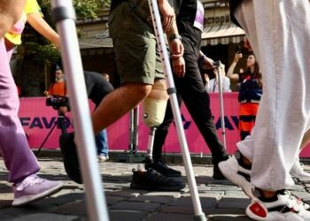 Держава не видасть вам дерев’яну ногу: все про безкоштовне протезування в Україні