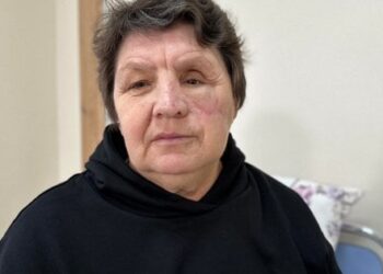 Львівські лікарі відновлюють обличчя мешканці Херсонщини, яка потрапила під обстріл