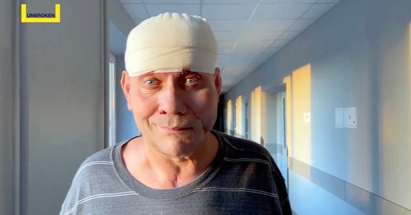 Ukrajinski in kanadski zdravniki presadili tkivo od nazaj do glave prebivalca Kherson regije