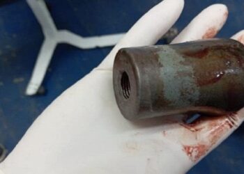 Лікарі польового госпіталю дістали з ноги захисника невідомий суббоєприпас