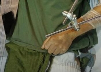 Міноборони розповіло, що входитиме в новий комплект адаптивного одягу для поранених