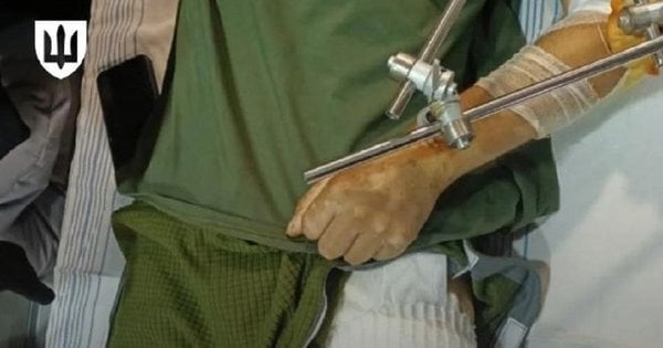 Міноборони розповіло, що входитиме в новий комплект адаптивного одягу для поранених