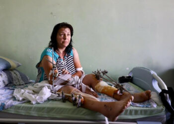 Ľvovskí ortopédi sa snažia zachrániť nohu 40-ročnej ženy pred amputáciou