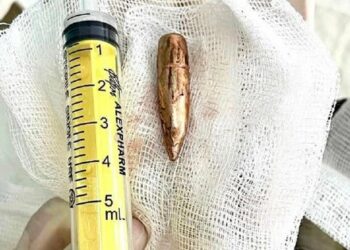 Khmelnytsky neurochirurgovia vytiahli guľku z chrbtice 27-ročného vojenského muža